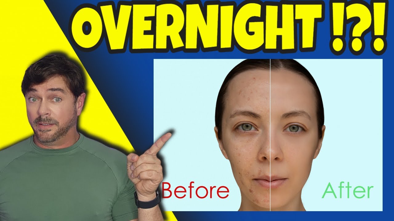 Exfoliation Benefits: Unlock Healthier Skin Now