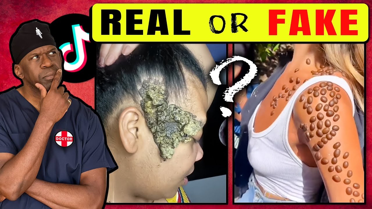 Medical TikTok Truths: Doctor Debunks Viral Health Claims