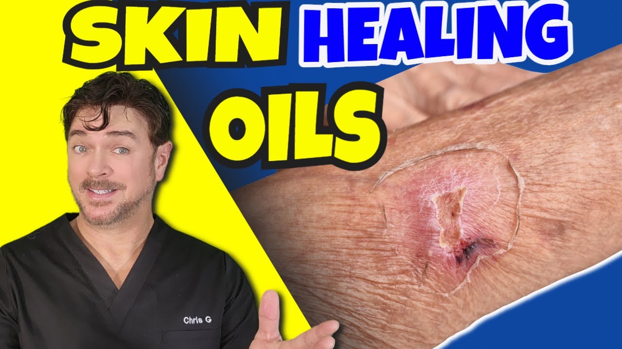 Natural Oils for Aging Skin: Expert Solutions for Spider Veins & Thinning Skin