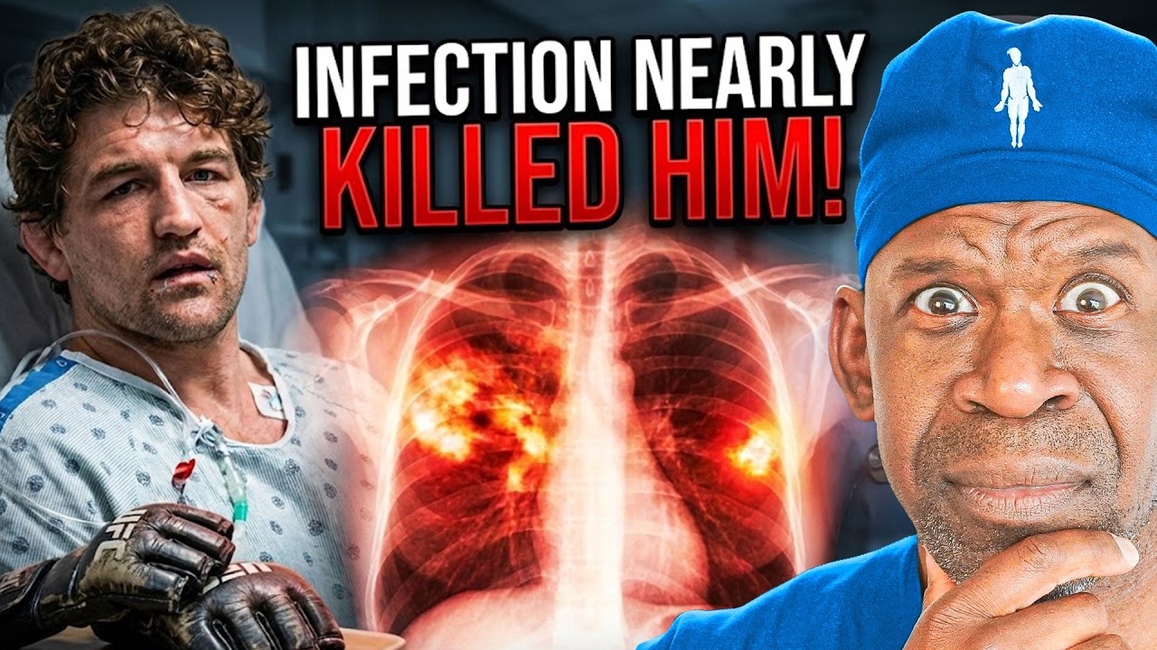 MRSA Pneumonia: Deadly Risk for Athletes & Prevention