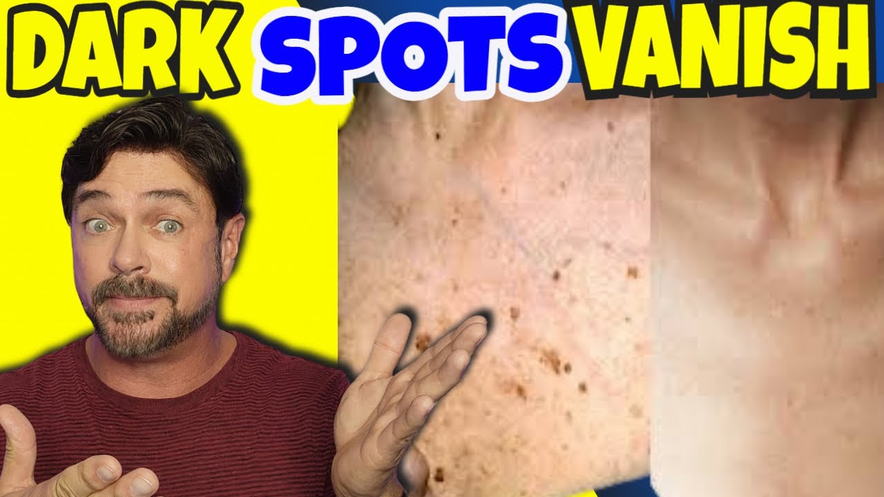 Turmeric Scrub for Dark Spots: Natural Skin Brightening Solution