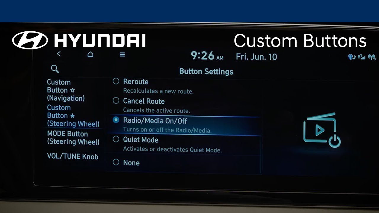Program Hyundai Custom Buttons for Quick Access Functions