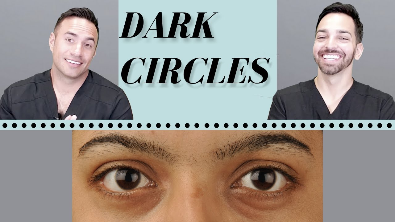 Dark Circles Under Eyes: Causes and Treatments Explained by Dermatologists