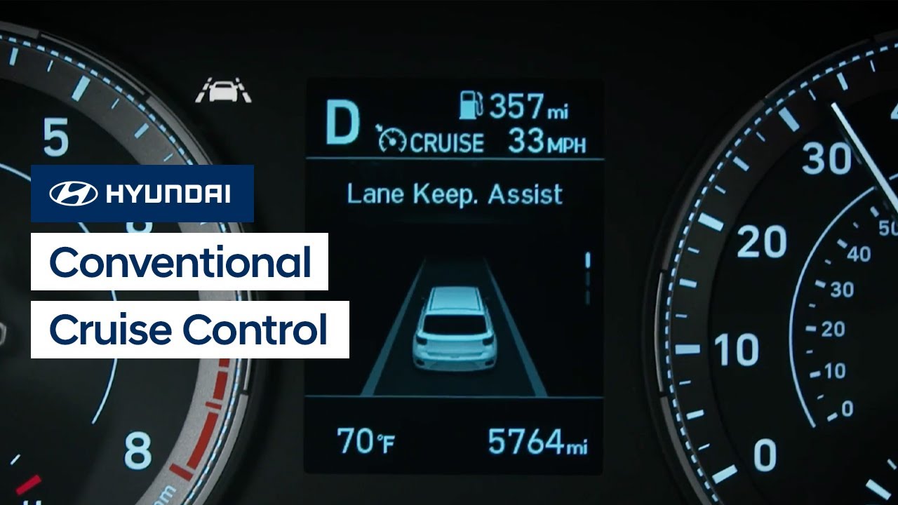 Master Hyundai Cruise Control: Type A vs B Setup Guide