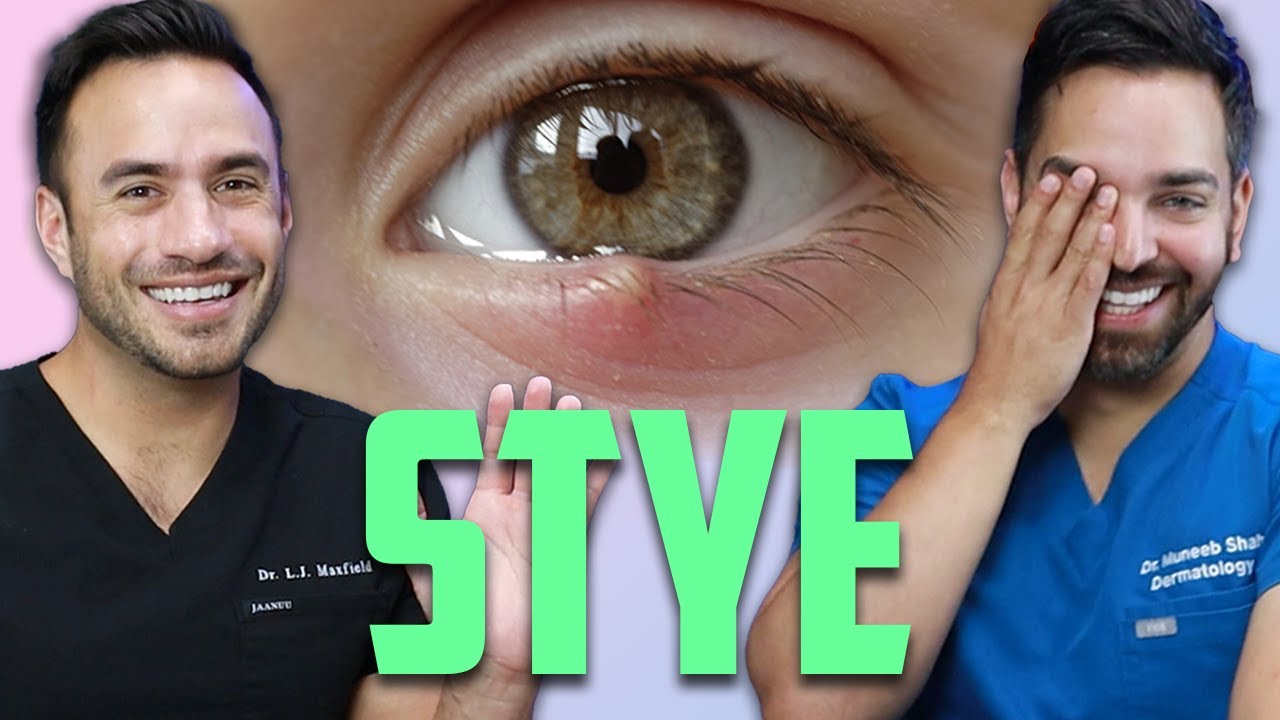 Stye Treatment: How to Safely Drain and Prevent Eye Infections
