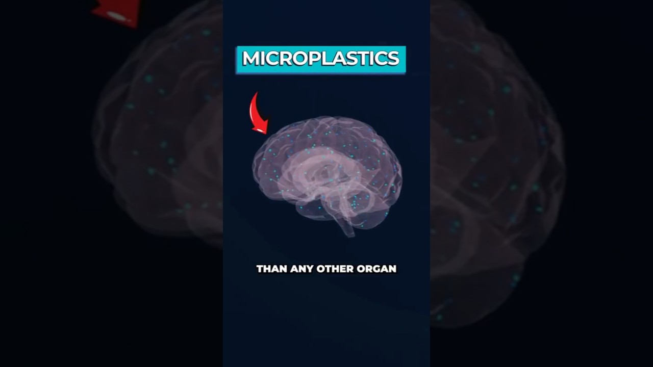 Microplastics in Brains: 50% Surge & Dementia Link Found