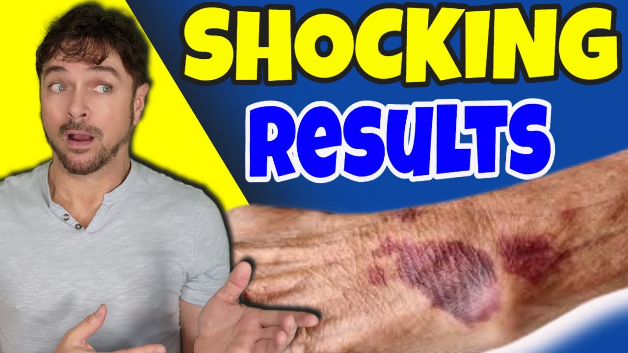 2 Ancient Oils That Reverse Aging Skin, Backed by Science