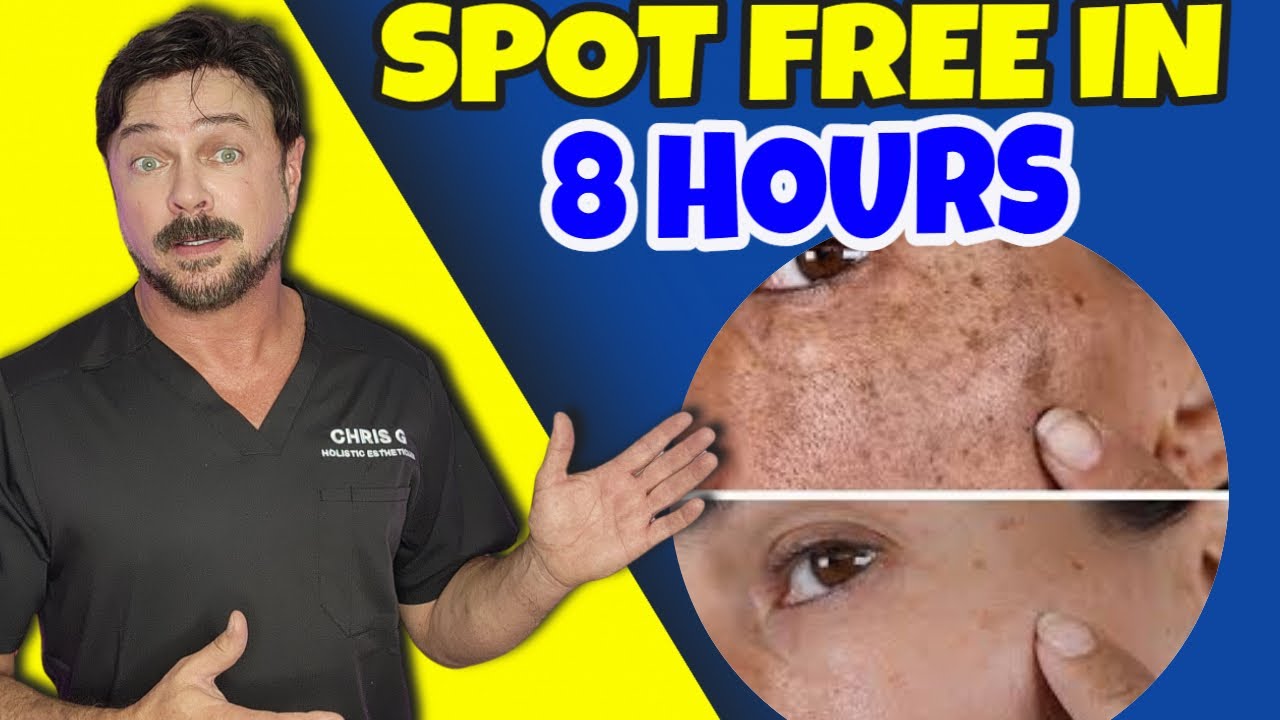 Fade Age Spots Fast: Micro-Dart Patches Explained (2024 Guide)