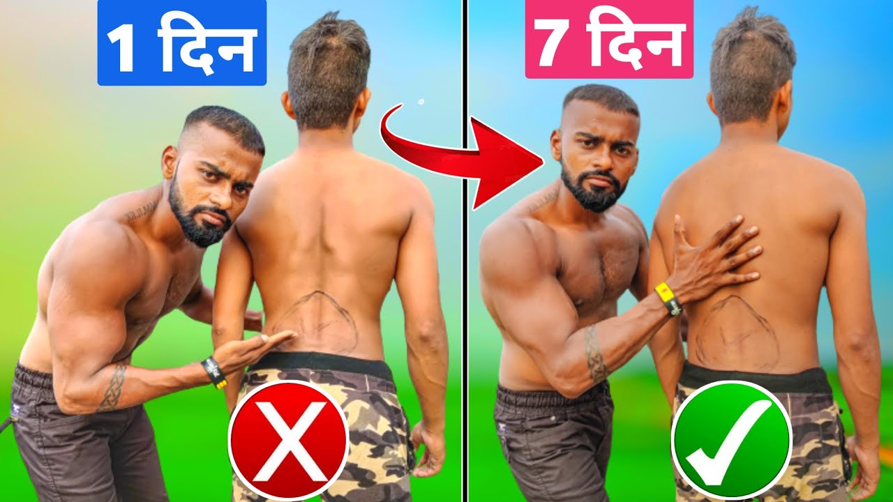 Fix Anterior Pelvic Tilt: Posture Correction Guide