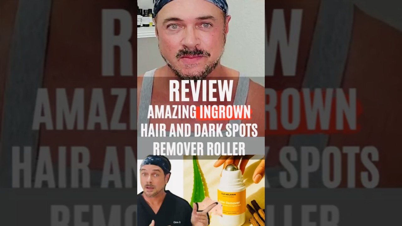 Ingrown Hair Solution: Roll-On Treatment for Bumps & Dark Spots