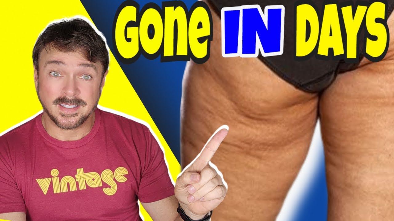 Top 5 Essential Oils for Natural Cellulite Reduction Backed by Science