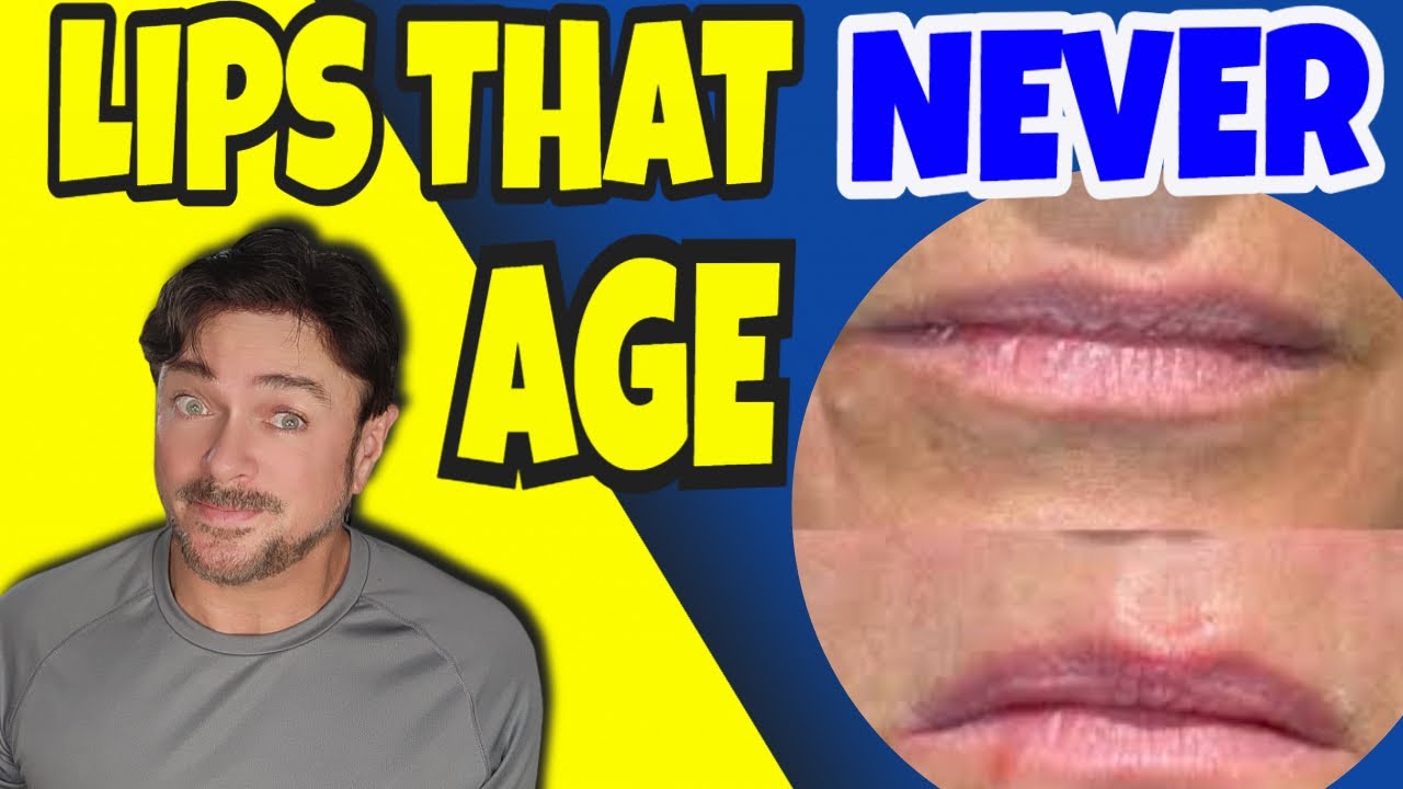 Revive Aging Lips: Expert Tips Without Fillers