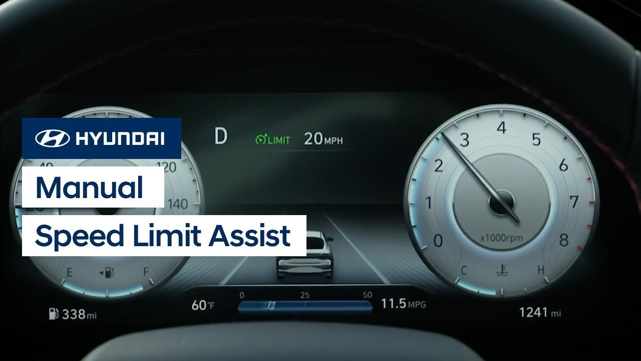 Master Hyundai's Driving Assist: Cruise vs Speed Limit
