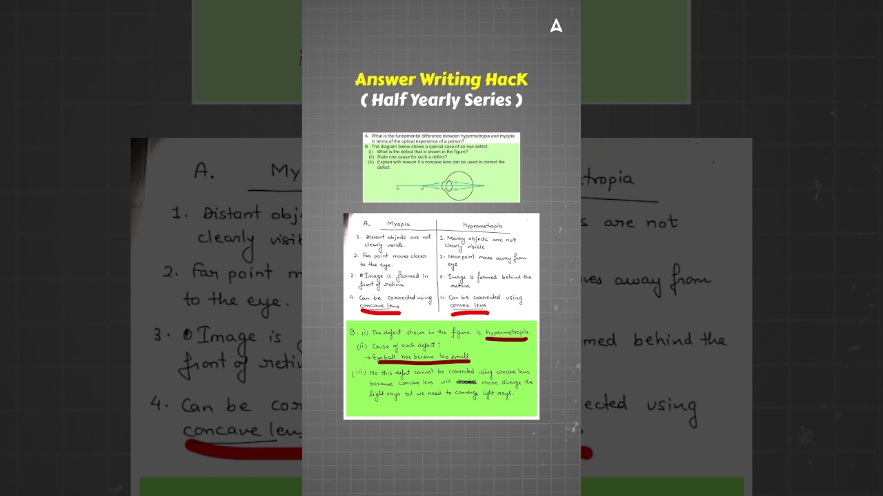 Myopia vs Hypermetropia: Class 10 Answer Guide & Diagram Analysis