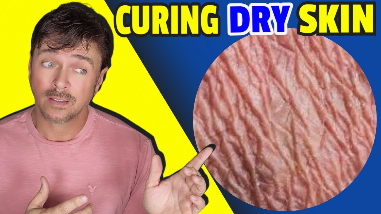 Fix Severe Dry Skin: Winter-Proof Barrier Repair Guide