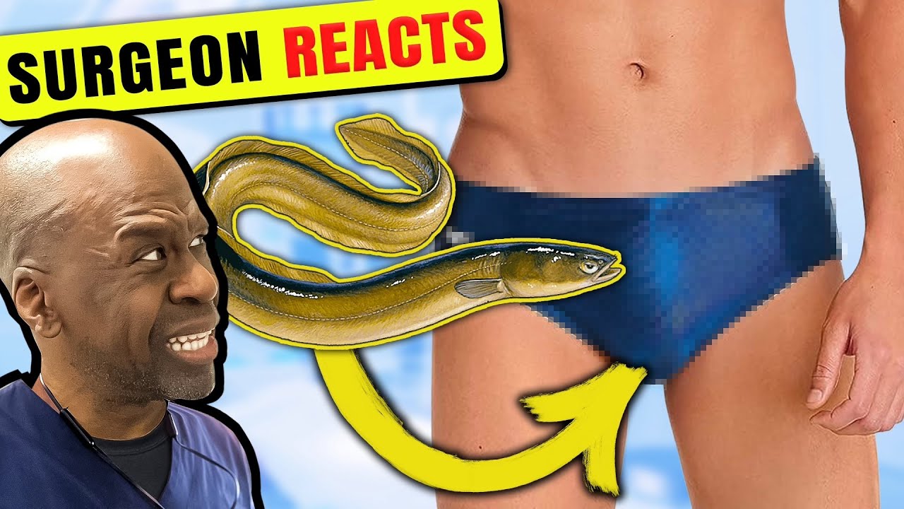 7 Weirdest Objects Found Inside Human Bodies Explained