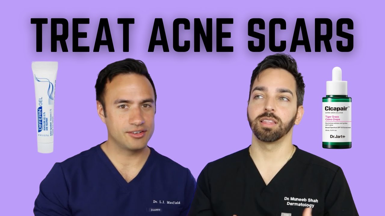Acne Scars Treatment Guide: Dermatologist-Approved Solutions