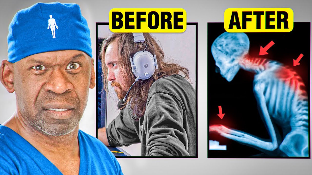 Gamer Health Crisis: Fix Pain with Movement Snacks