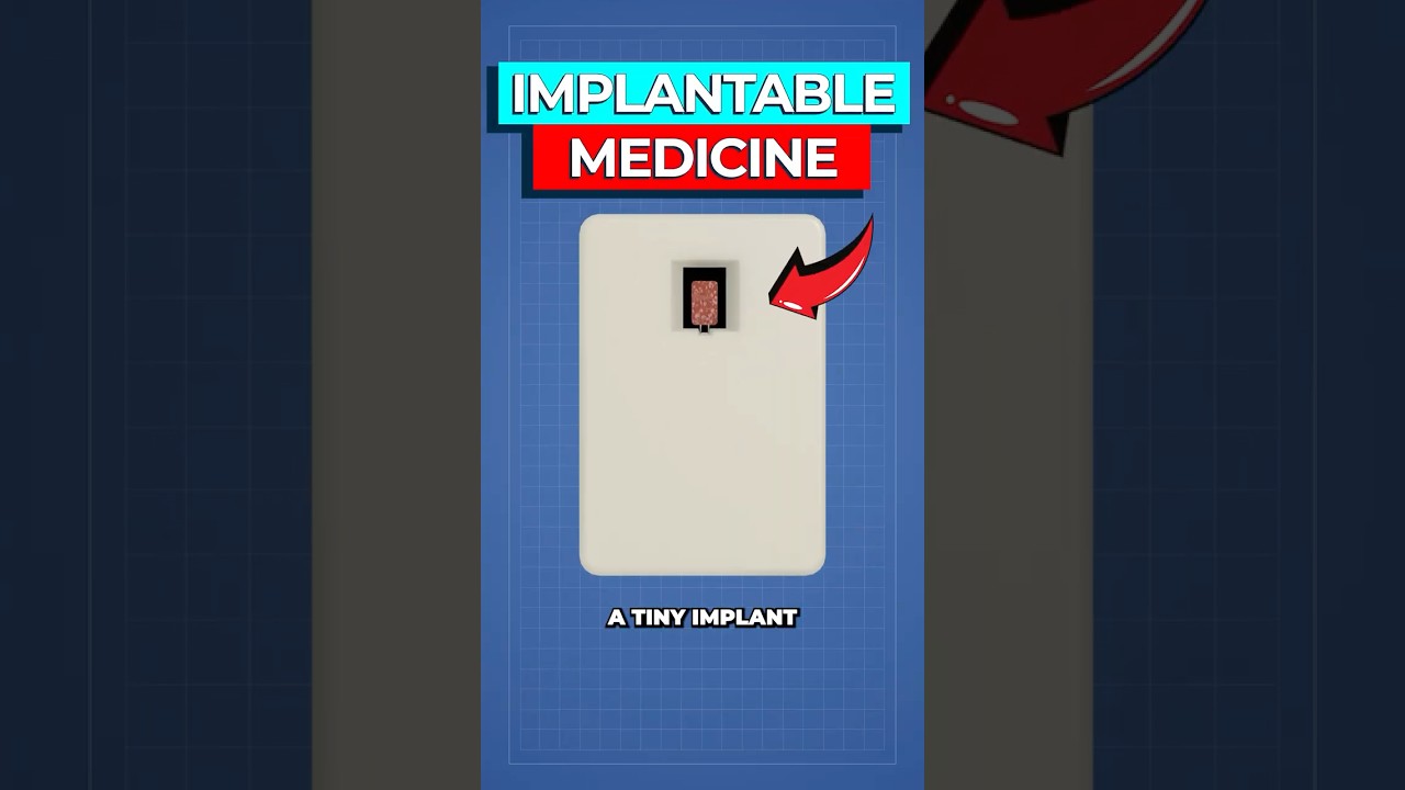 MIT's Emergency Diabetes Implant Prevents Hypoglycemia