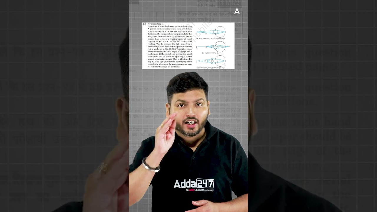 Hypermetropia: Symptoms, Causes & Convex Lens Correction