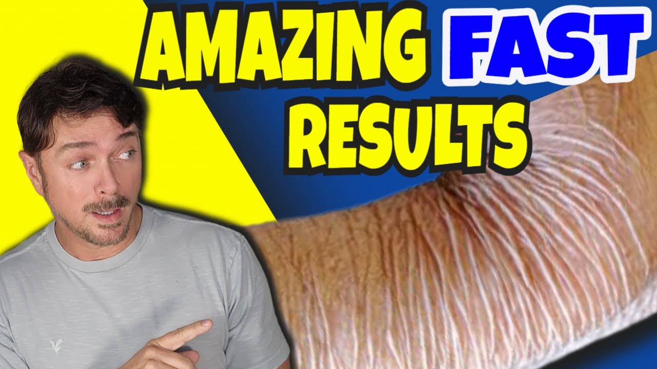 Natural Oils to Repair Thinning Skin: Holistic Solutions Backed by Science