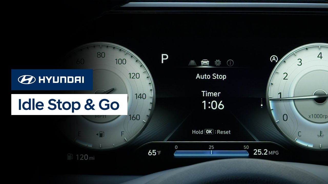 Hyundai ISG System: Complete Owner's Guide & Troubleshooting