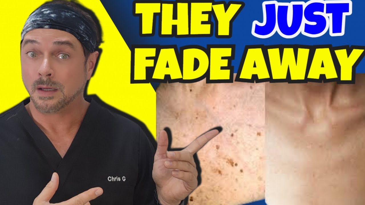 Natural Dark Spot Solutions for Darker Skin | Expert Review