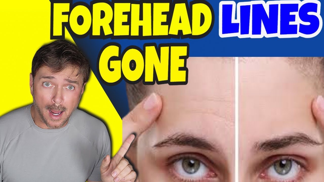 Bounceback Forehead Treatment Review: Does It Blur Wrinkles?