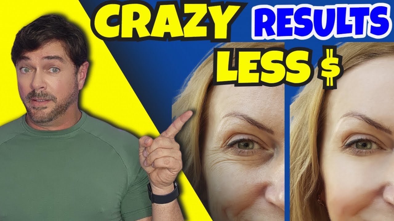 3 Proven Botox Alternatives for Younger Skin