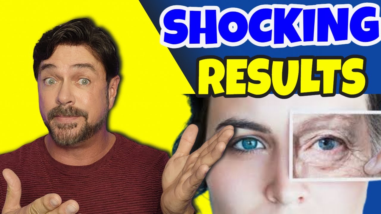 5 Natural Oils That Transform Aging Eye Skin (Dermatologist Tips)