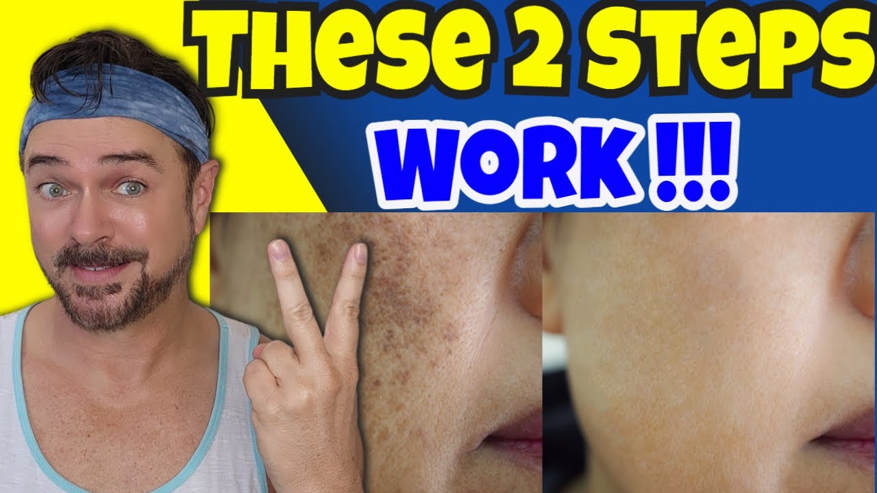 How to Fade Dark Spots Fast: Dermatologist-Approved 2-Step Routine