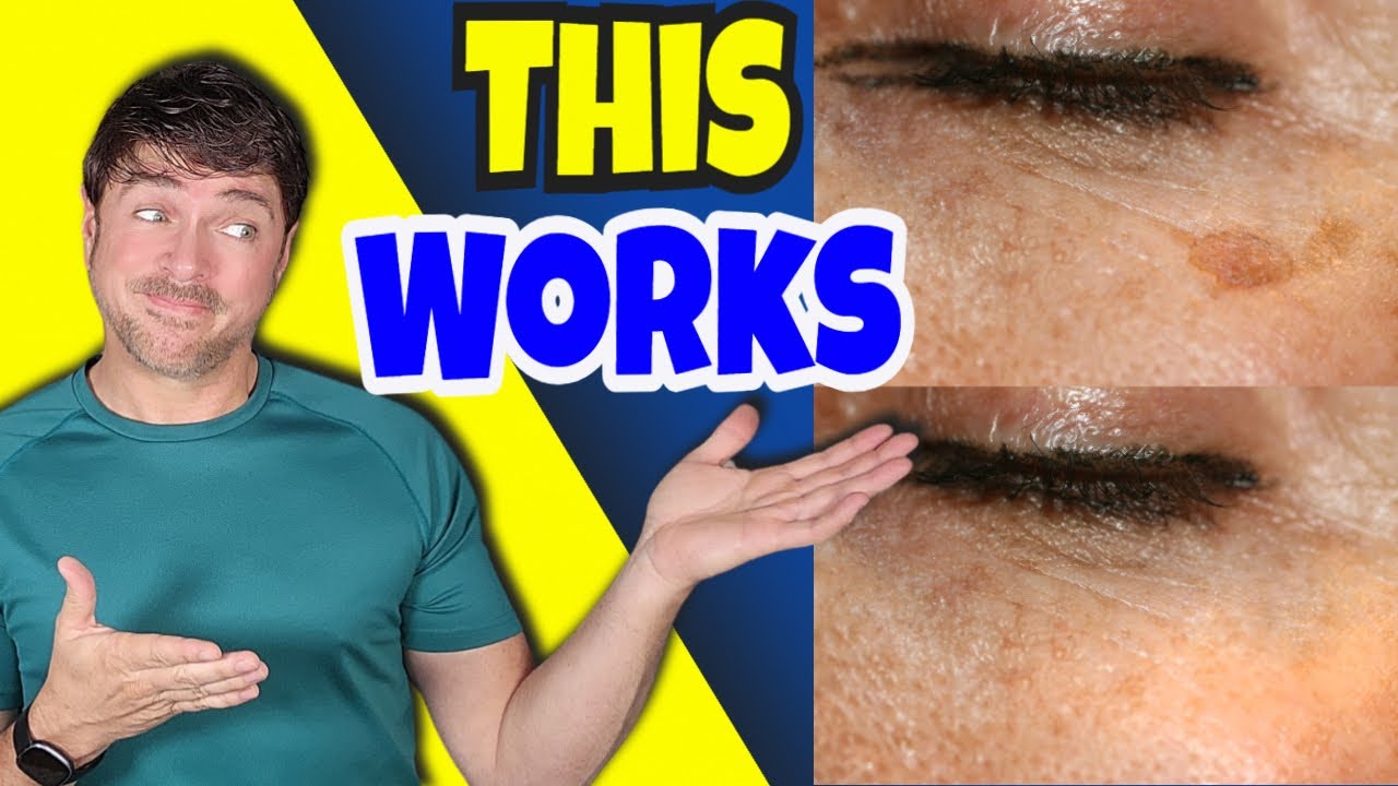 Top 7 Budget Skincare Acids That Reverse Aging Signs