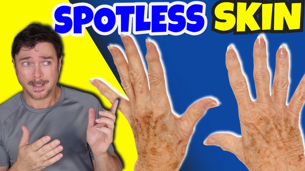 Glow Melanin Roller Remover Review: Ingrown Hair & Dark Spot Solution