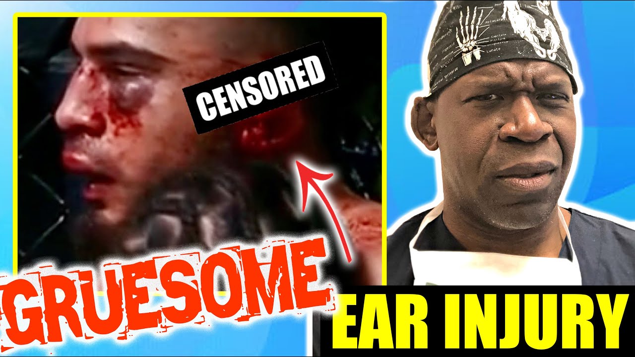 UFC Ear Injury Explained: Treatment & Recovery from Auricular Avulsion