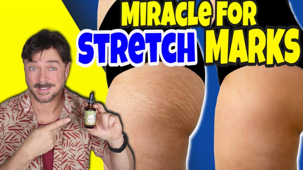 Argan Oil for Stretch Marks: Proven Reduction & Prevention