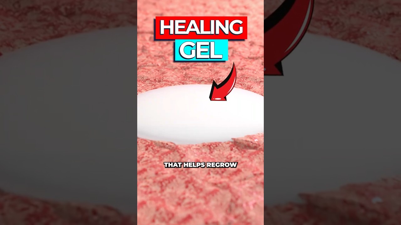 Diabetic Wound Healing Gel Breakthrough: How MicroRNA Spurs Regrowth