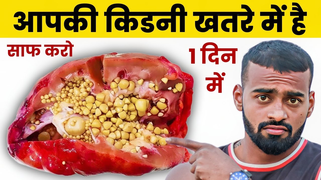 Natural Kidney Detox: 4 Proven Methods to Cleanse Safely