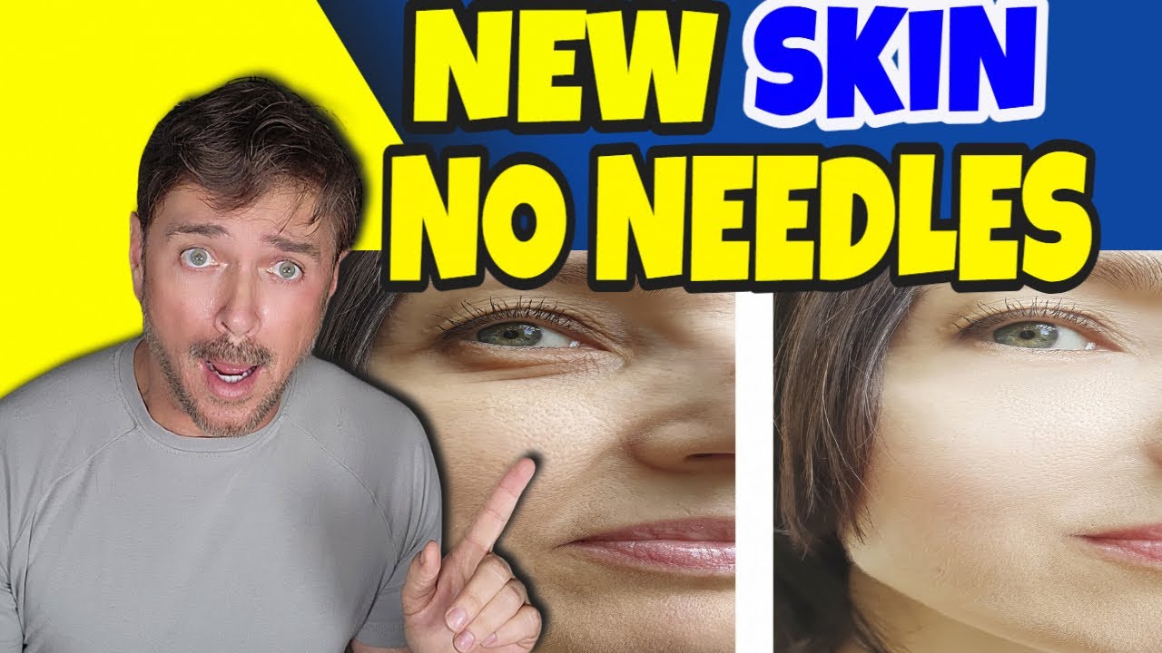 Needle-Free Microneedling Alternative: Achieve Youthful Skin Without Pain