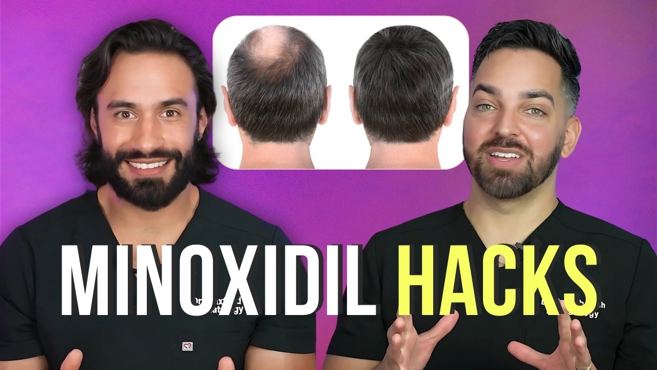Top Minoxidil Hacks for Maximum Hair Growth Results
