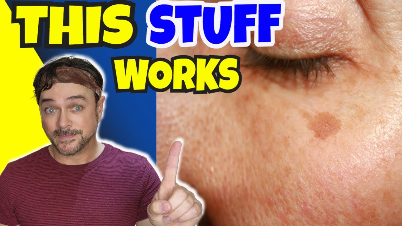 Turmeric Skincare: Fade Dark Spots Naturally in 30 Days