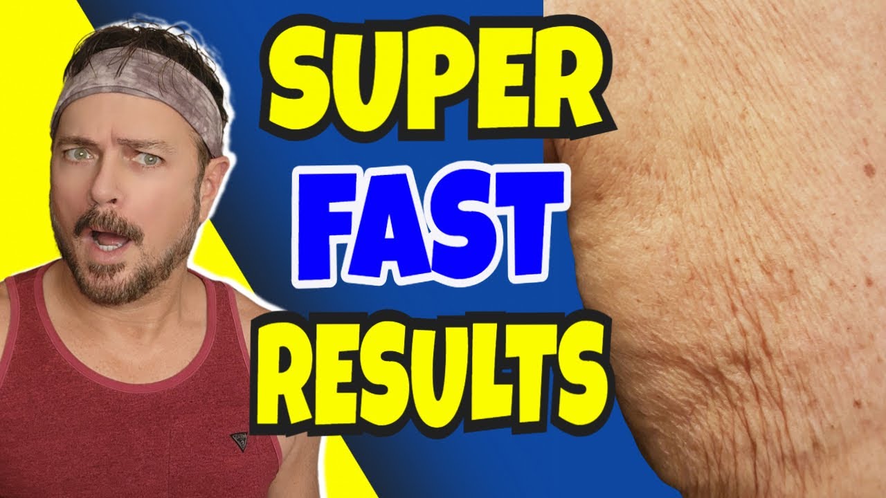 3-Step Solution for Crepey Skin on Body