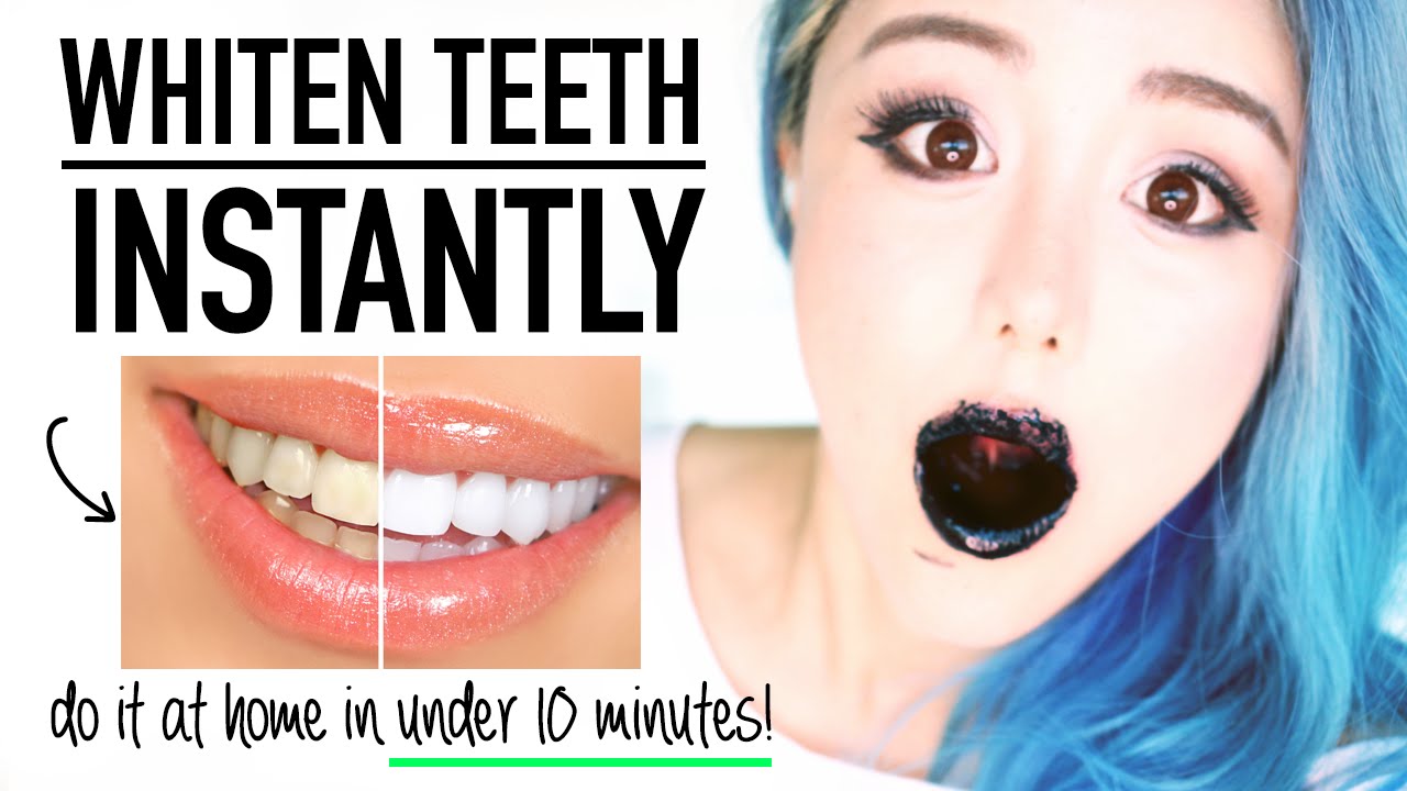 Activated Charcoal Teeth Whitening: Natural Results Guide
