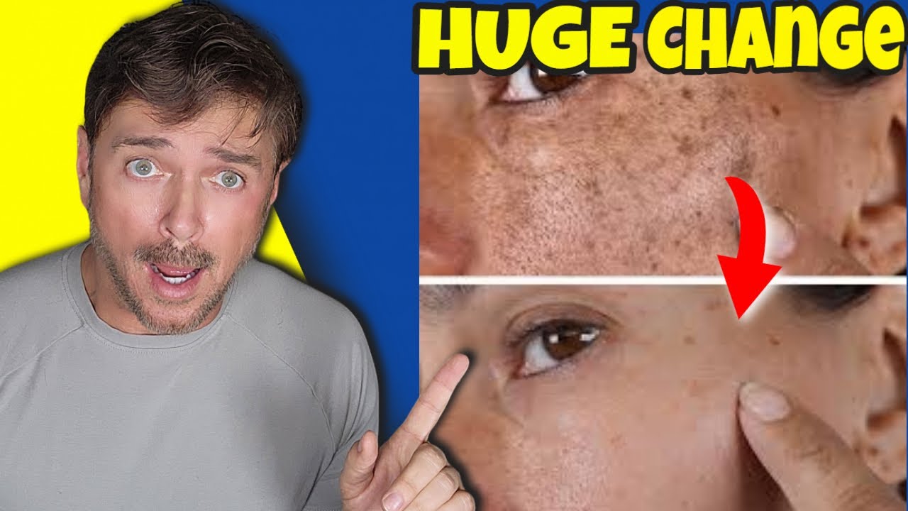 3 Natural Oils for Brighter Skin & Age Spot Reduction