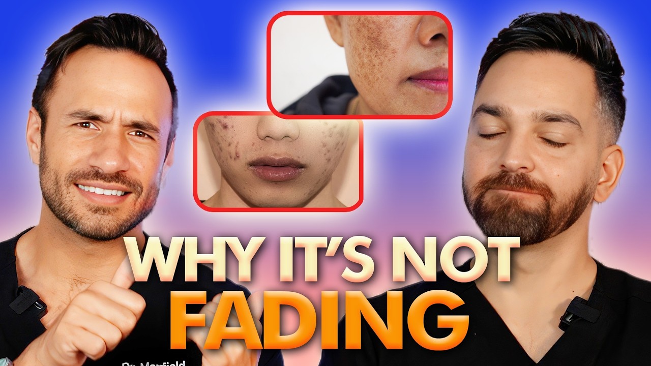 Top Dark Spot Mistakes to Avoid for Clearer Skin