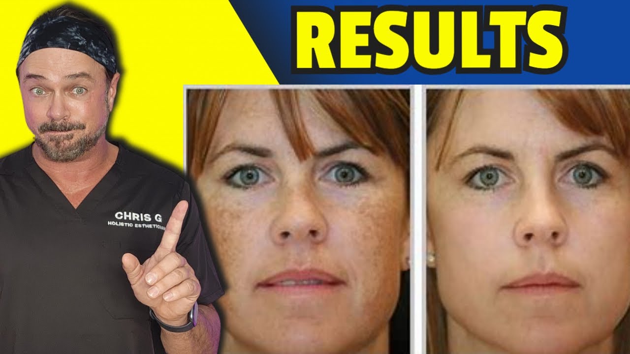 New Skincare Routine Guide: Layer Products for Best Results