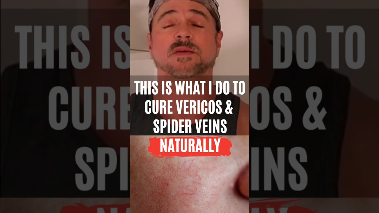 Hoba Oil for Skin Hydration: DIY Blend to Reduce Spider Veins