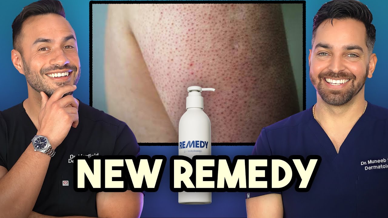 Remedy Body Bumps Review: Dermatologist KP Treatment Explained