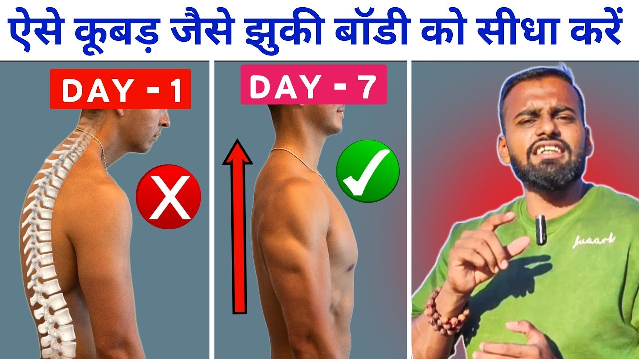 How to Fix Forward Head Posture (Hunched Neck)