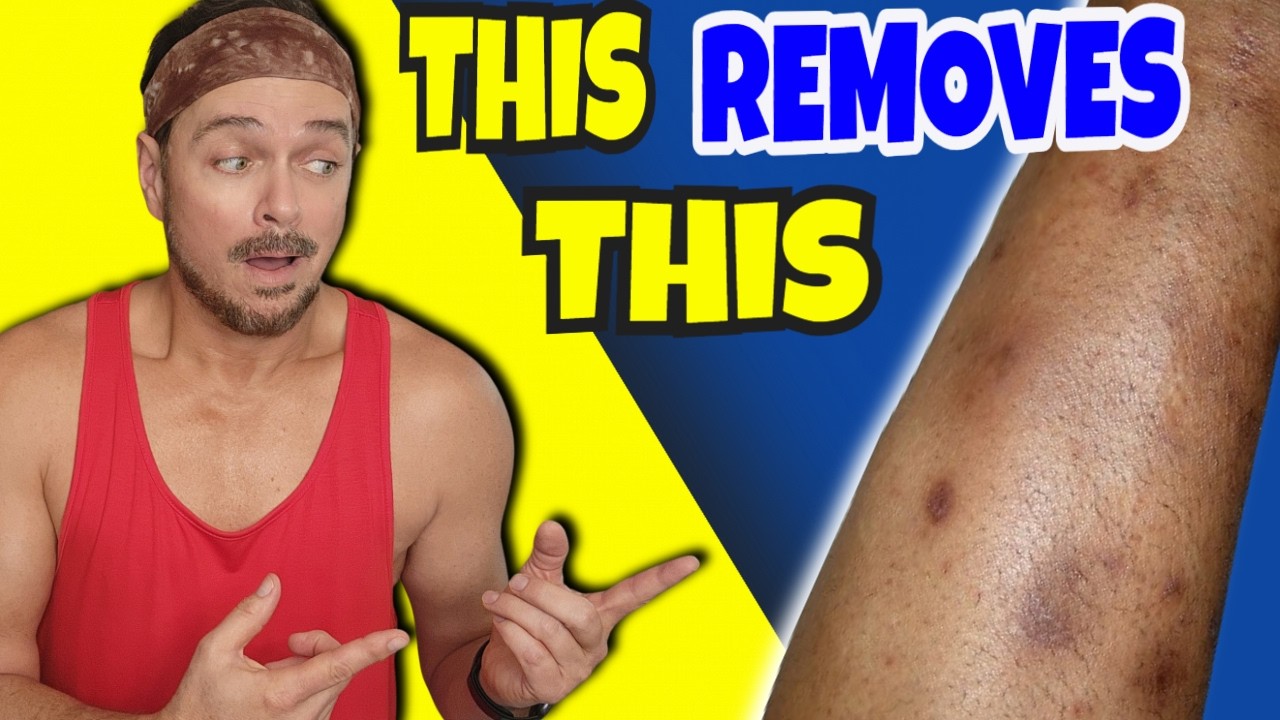 Fade Body Hyperpigmentation: 2-Step Routine That Works