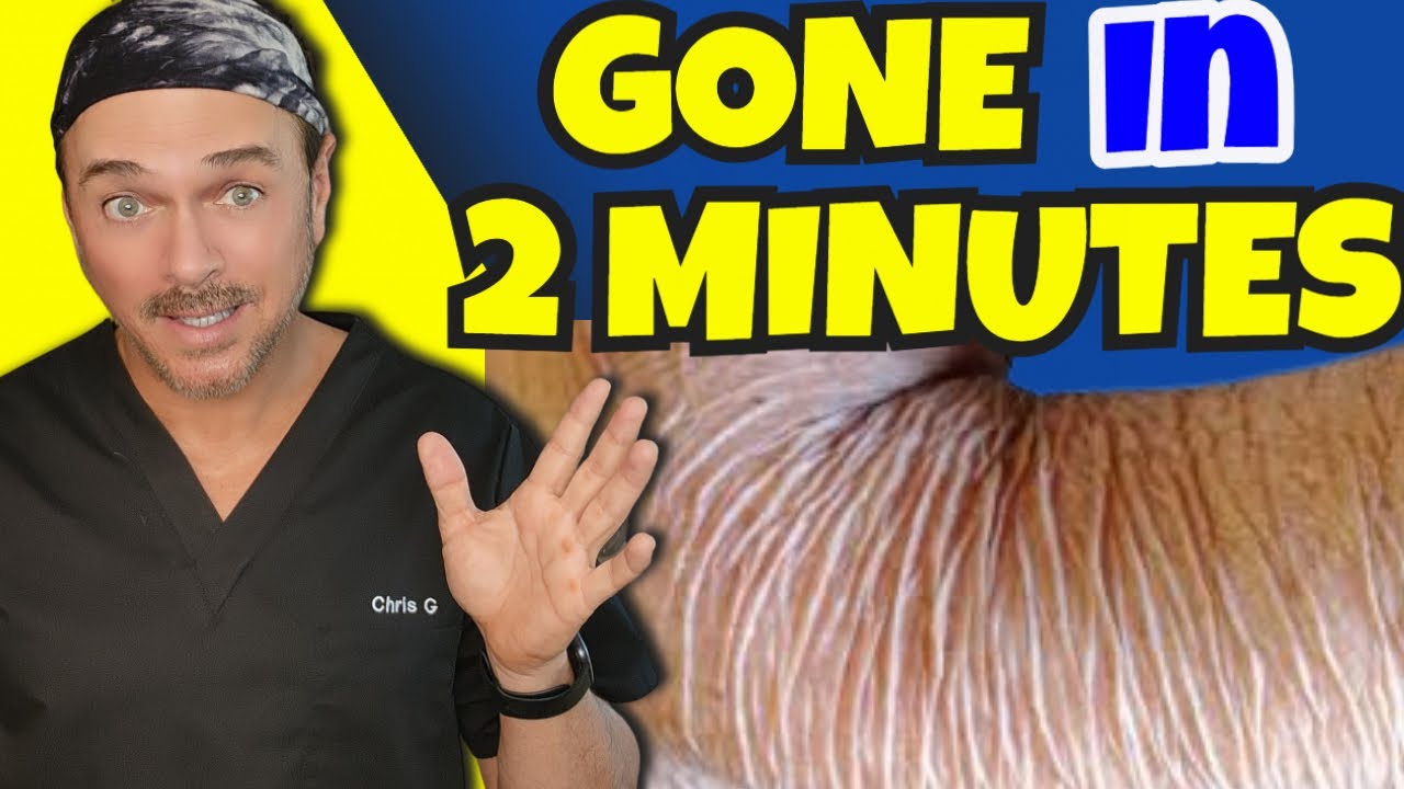 Fix Crepey Skin Fast: 2-Step Routine That Works